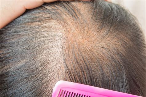 Hair Thinning & Hair Loss - Men - 28 Products | Ulta Beauty - balustradellc