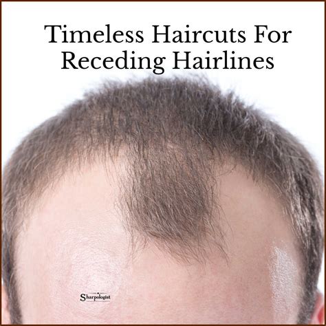 Haircuts for Receding Hairline | All Thins Hair US - All … - balustradellc