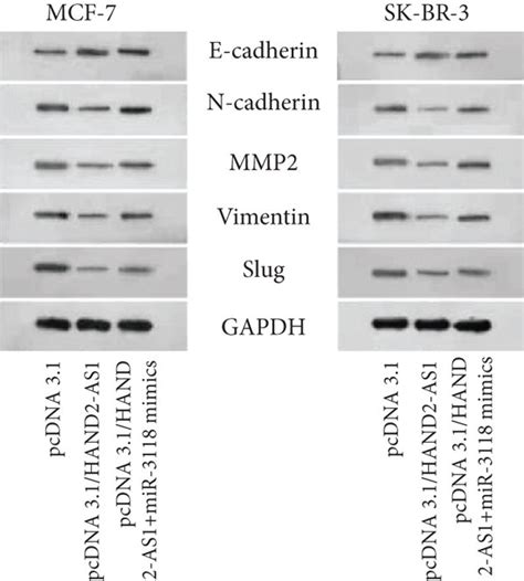 HAND2-AS1 Works as a ceRNA of miR-3118 to Suppress …