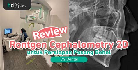 Harga Rontgen Cephalometri - wintechmobiles.com