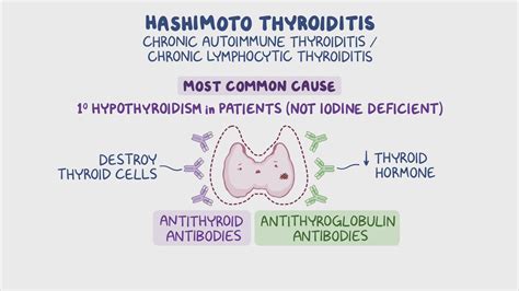 Hashimoto's Thyroiditis - Johns Hopkins Medicine - muktibox.com