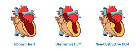 HCM - Health Club Management magazine | social … - coolestguyplanet.net