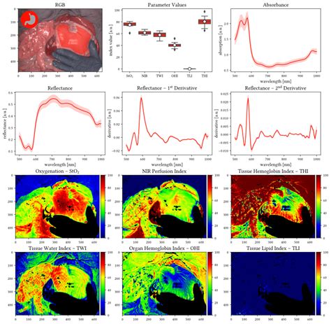 Heidelberg Profiles - Heidelberg University - wintechmobiles.com