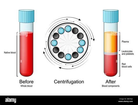 Hematocrit Blood Test Tube Centrifuge - wintechmobiles.com