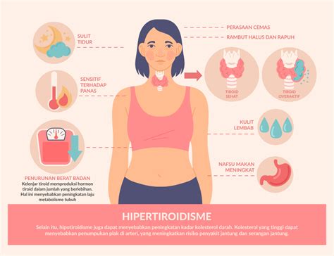 Hipertiroidisme: Penyebab, Gejala, dan Pengobatan - balustradellc