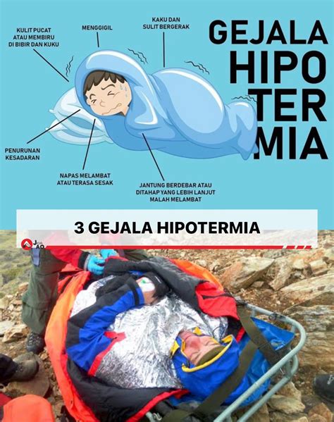 Hipotermia Ringan: Gejala dan Pertolongan Pertama - balustradellc
