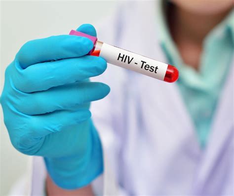HIV Testing Ambar Lab