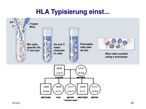 HLA-Typisierungen