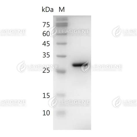 HMGB1, His, Human - GenScript