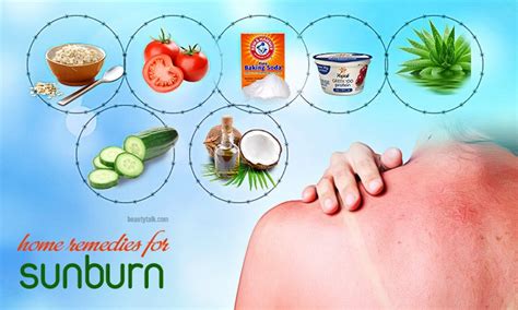 Home Remedies for Sunburn Treatment - The Old … - balustradellc