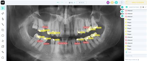 How AI is Revolutionizing Dental X-Ray Interpretation - coolestguyplanet.net