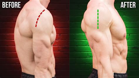 How I Fixed Rounded Shoulders Forever - balustradellc