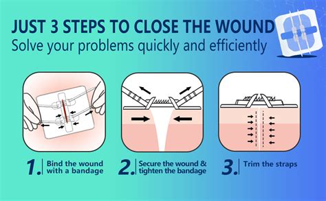 How to Apply Butterfly Wound Closures - Biology Insights - balustradellc