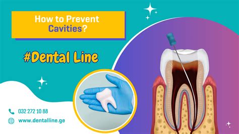 How to avoid cavities | Watch - MSN - balustradellc