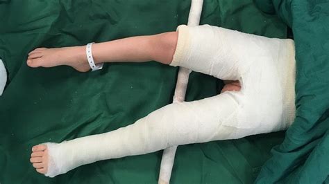 HOW TO CAST & RE-ASSEMBLE YOUR … - muktibox.com