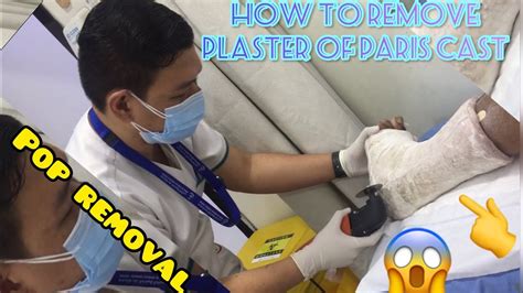 How To Clean A Plaster Cast - muktibox.com