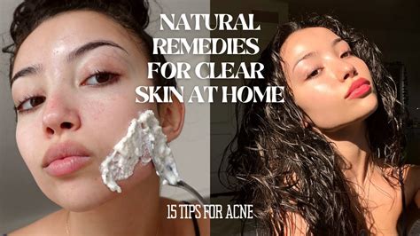 How To Clear Skin Overnight | Rapid Glow Secrets - balustradellc
