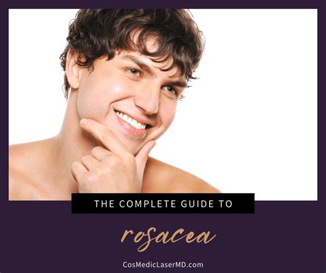 How to Control Rosacea on the Face: A Complete … - balustradellc