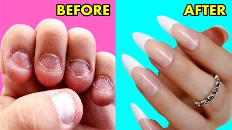 HOW TO MAKE NAILS THICKER: A FAST DIY AT HOME