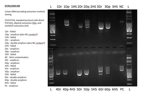 How to Read Electrophoresis Results: Gels and Reports - wintechmobiles.com