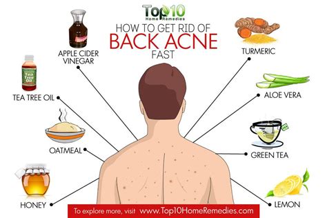 HOW TO REMOVE BACK ACNE FAST MEN