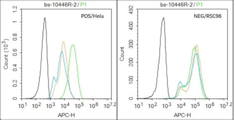 HPV16-E7 Polyclonal Antibody (BS-10446R)