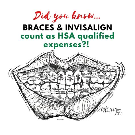 HSA for Orthodontics and Braces Braces Explained