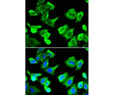 HSP27 Rabbit pAb - ubpbio.com