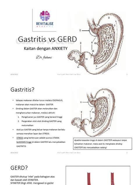 Hubungan Kecemasan dan GERD | PDF | Sains