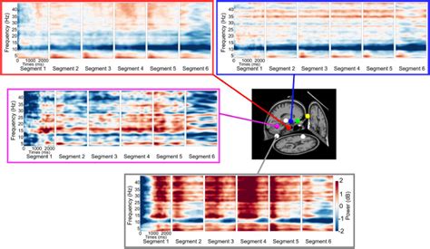Human brain dynamics in active spatial navigation - PMC - wintechmobiles.com