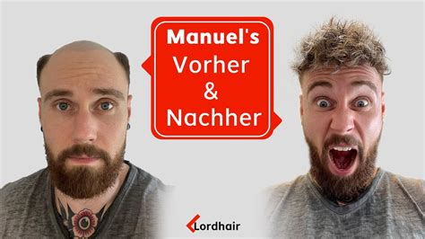 Haarausfall ade: Die ultimative Transformation mit Haarperücken für Männer