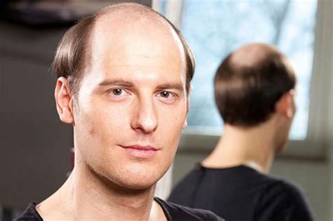 Haarersatz für Männer: Finden Sie Ihre perfekte Haarpracht