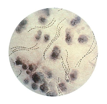 Haemophilus ducreyi (Neveu-Lamaire) Bergey et al. - 700724