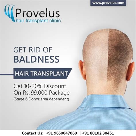 Hair Transplant Clinic For Badlness Hair Loss