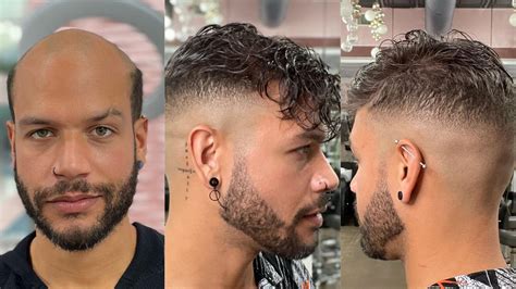 Hair system. NEU Hair 4 Men replacement systems are high-quality hair pieces made with 100% real human hair. Our hair systems are designed to replace completely or ... 