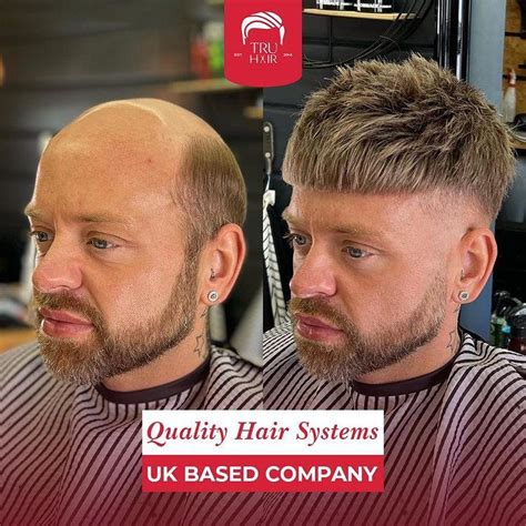 Hair systems for men. Hair loss is a common concern for many individuals, both men and women alike. While there are various factors that can contribute to hair loss, using the right hair loss shampoo ca... 