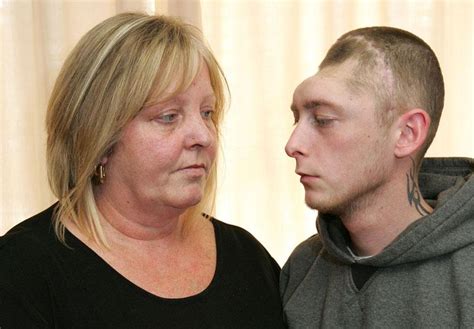 Halva huvudet domnar bort