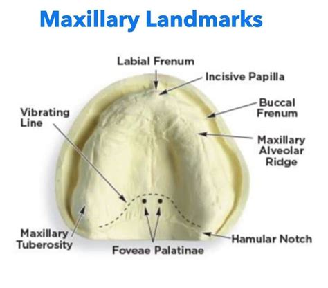 Hamular Notch: LEC2 PROSTHODONTIC Abdul Sattar image 1
