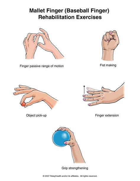 Hand Rehab: How To Recover From A Hand Injury STACK