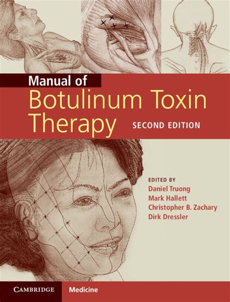 Handbook of botulinum toxin treatment 2nd edition. - Study guide for nevada security work card.