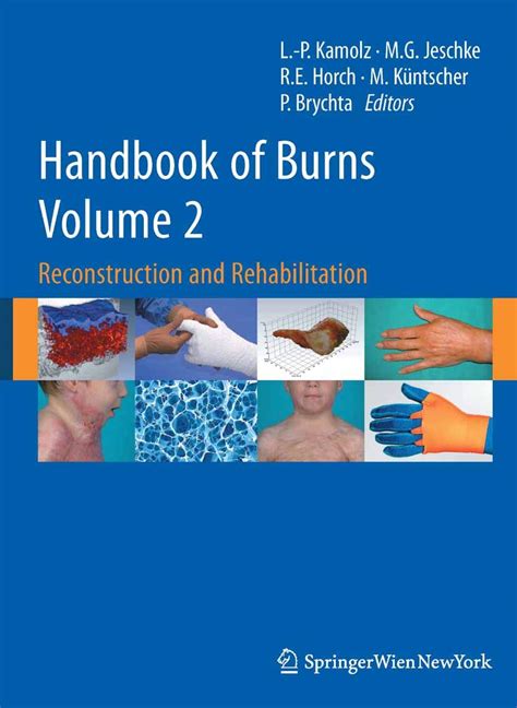 Handbook of burns volume 2 reconstruction and rehabilitation. - Bedeutung des erfolges für das problem der strafmilderung beim versuch.