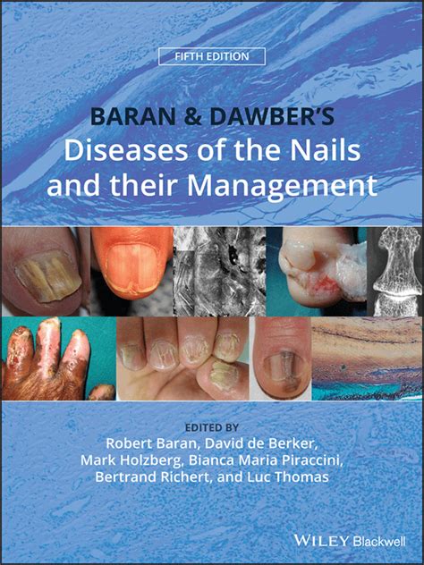 Handbook of diseases of the nails and their management. - Chevy express van 1995 2015 repair manual.