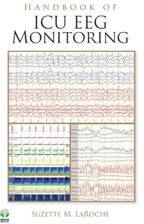 Handbook of icu eeg monitoring by suzette m m laroche md. - The complete guide to the nextstep tm user environment the.
