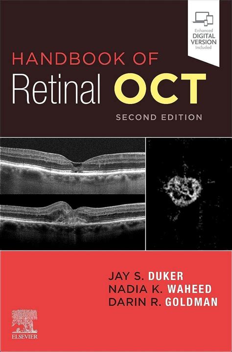 Full Download Handbook Of Retinal Oct Optical Coherence Tomography Expert Consult Online And Print By Jay S Duker