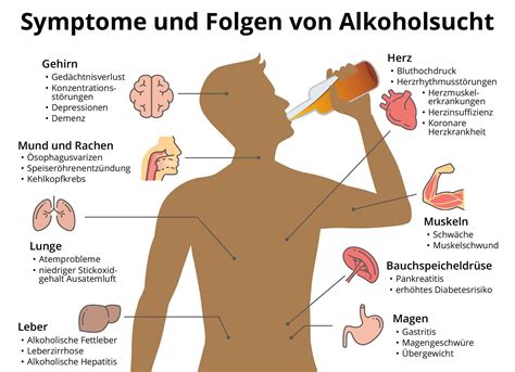 Handbuch zur behandlung von klinischem alkoholismus. - Sobre la composicion literaria, sobre dinarco.