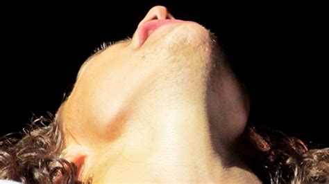 Harry Styles' Chin Scar: Taylor Swift Connection Explained!.