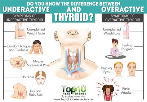 Has anybody had the feeling of tightness/constr... - Thyroid UK