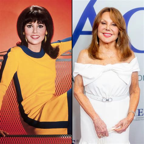 How actress Marlo Thomas has changed after plastic surge