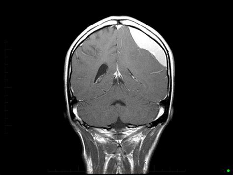 Head / Brain MRI - Paediatic MRI Series