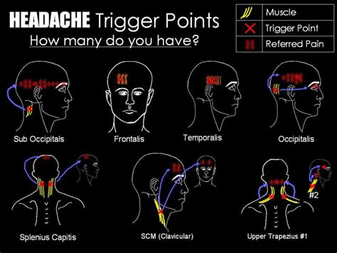 Headache Massage How to Help Relieve a Tension Headache